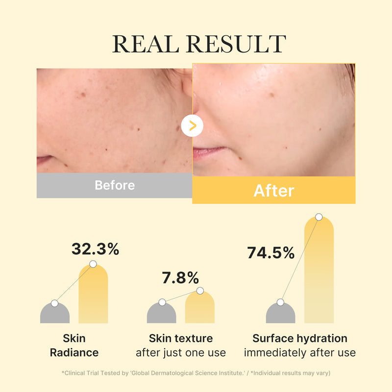 Kojic Acid Turmeric Gold Jelly Gel Mask