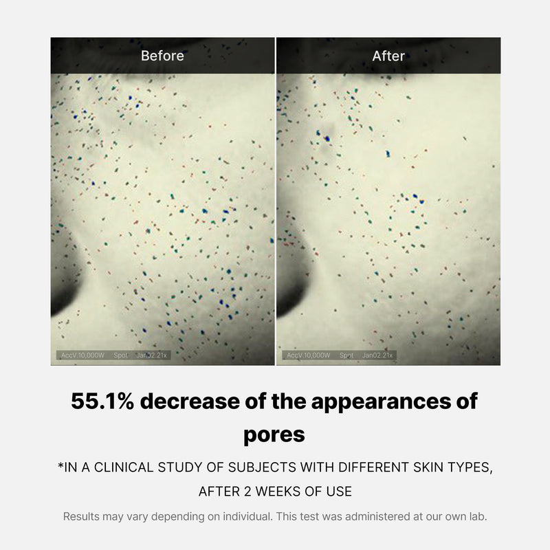 Pore Care Duo