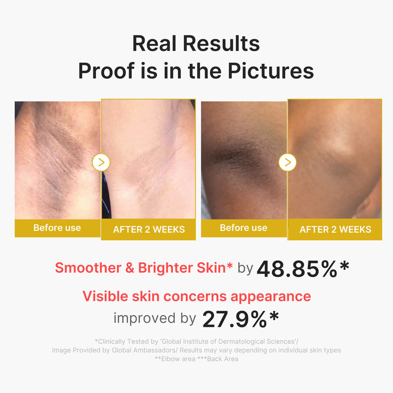 Kojic Acid Turmeric Body Peel Shot