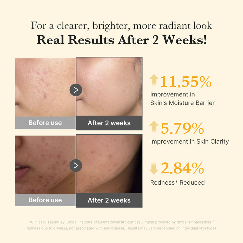 Kojic Acid Turmeric Capsule Serum